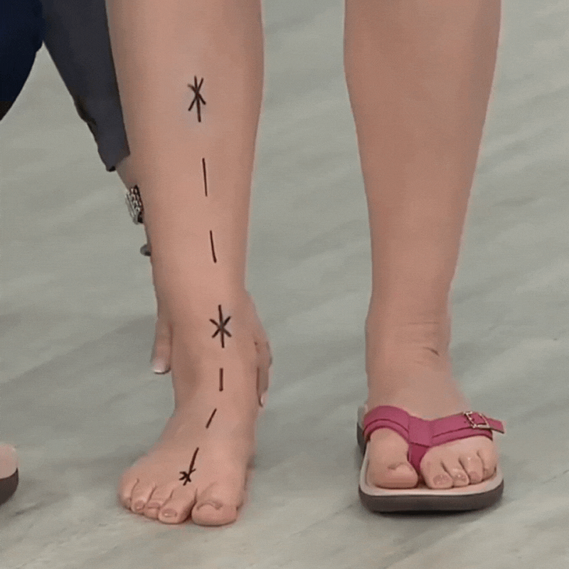 Orthopaedic summer sandals
